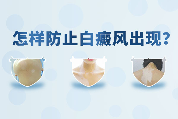 如何預(yù)防白癜風(fēng)比較科學(xué)呢？