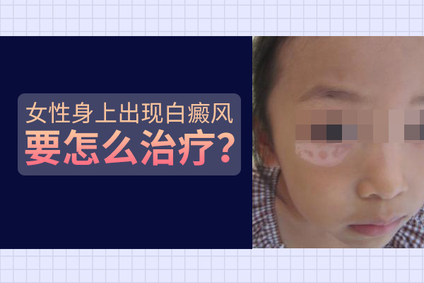 女孩子臉上長塊白癜風要怎么處理呢？