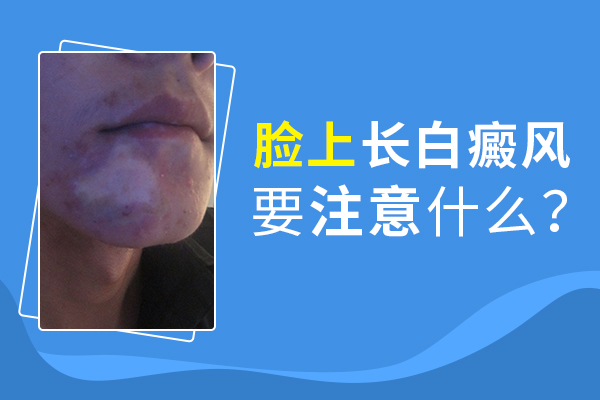臉部白癜風(fēng)患者應(yīng)該怎么護理呢？