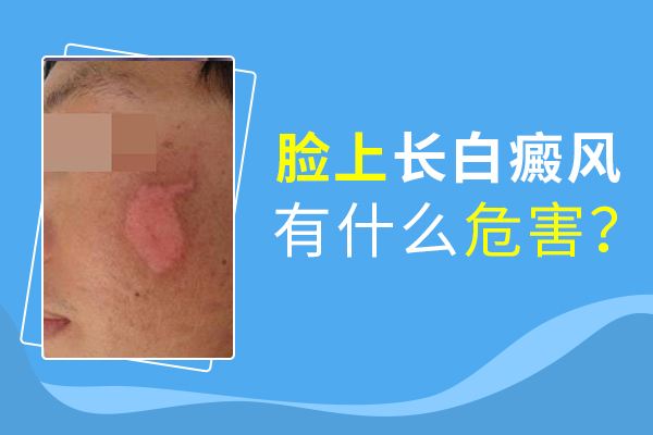 臉部白癜風(fēng)會(huì)給患者帶來(lái)什么傷害呢？